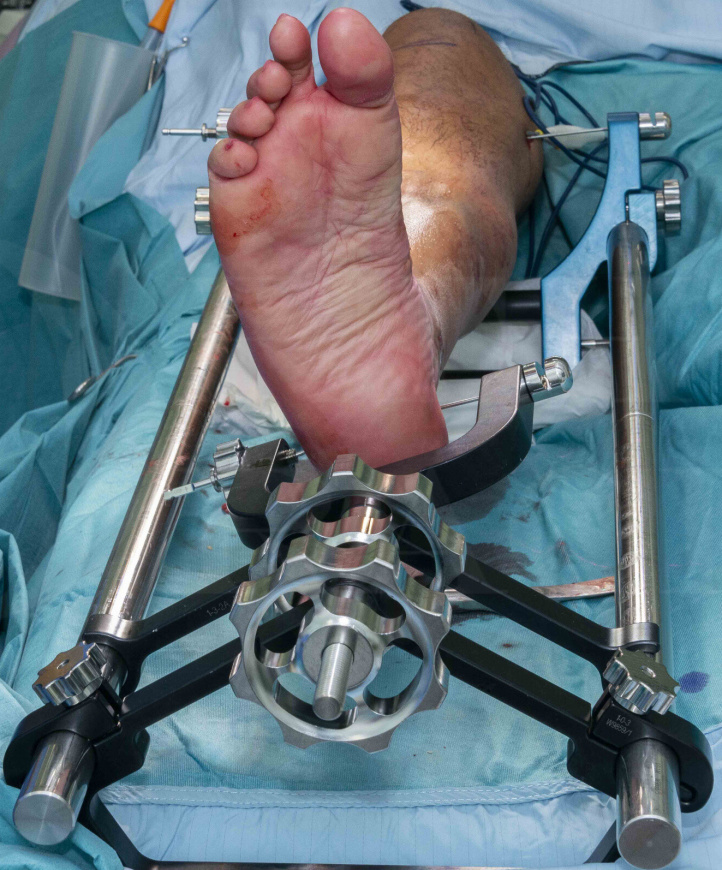 Orthobullets - Below are the post-operative images of the... | Facebook
